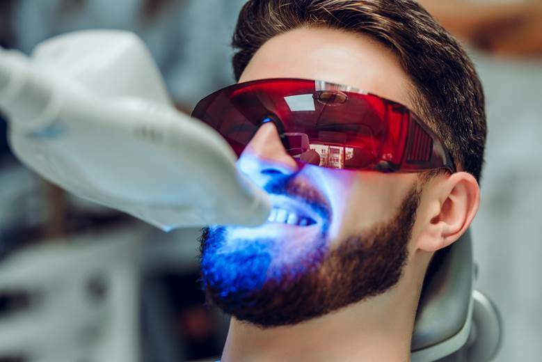 Closeup of patient during in-office ZOOM! teeth whitening in Edmonton