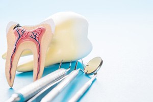 tooth replica representing cost of root canal in West Edmonton